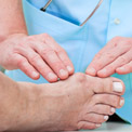 What Causes Bunions?